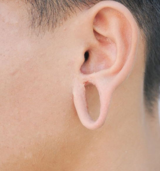 Ear-Lobe-Correction