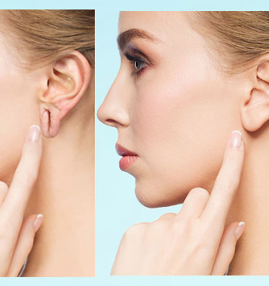 Ear-Lobe-Correction