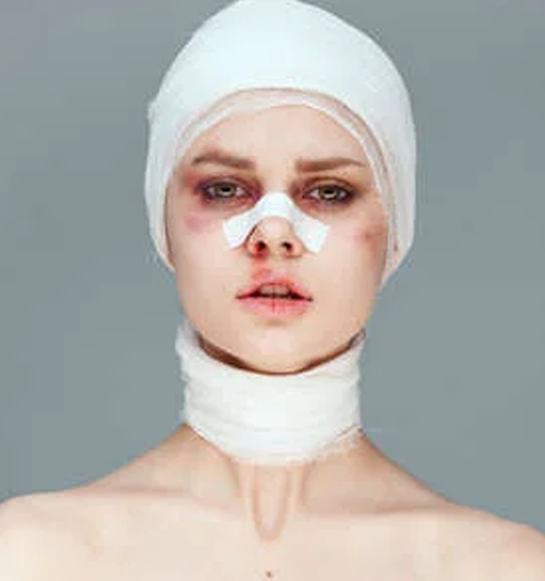 Facial-Injuries